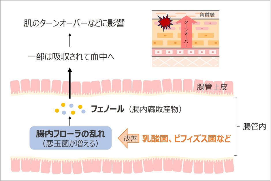 肌に対する腸内フローラの乱れの影響　イメージ図