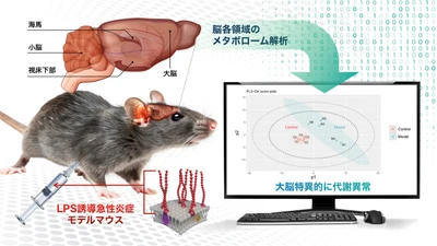 体の炎症反応が"大脳"に影響する？　全身性炎症から神経障害が発現する機序の解明に期待