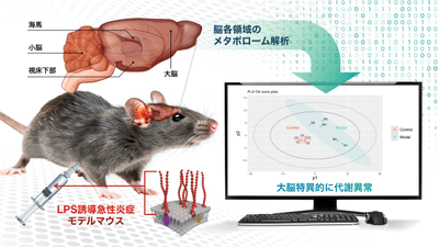 本研究の概要図（炎症モデルマウスの脳を解析し、大脳の代謝異常を確認）