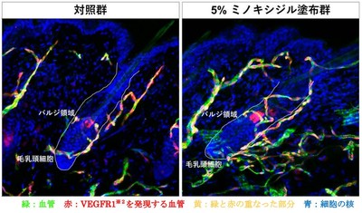 図１　ミノキシジル塗布による毛包周囲の血管の増加