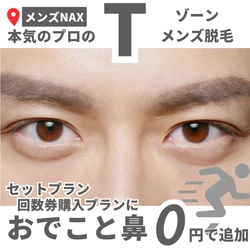 【Tゾーンの脱毛】おでこと小鼻もムダ毛は生えている！トーンや黒ずみ対策に！