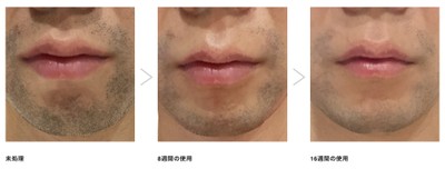 定期的なフェイスケア