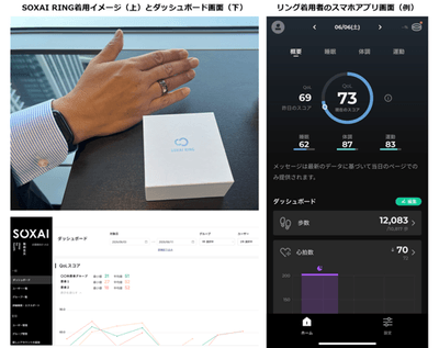 「SOXAI RING」の使用イメージ