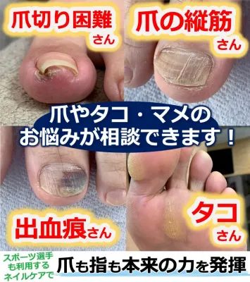 足元から快適な歩行を見直しませんか?