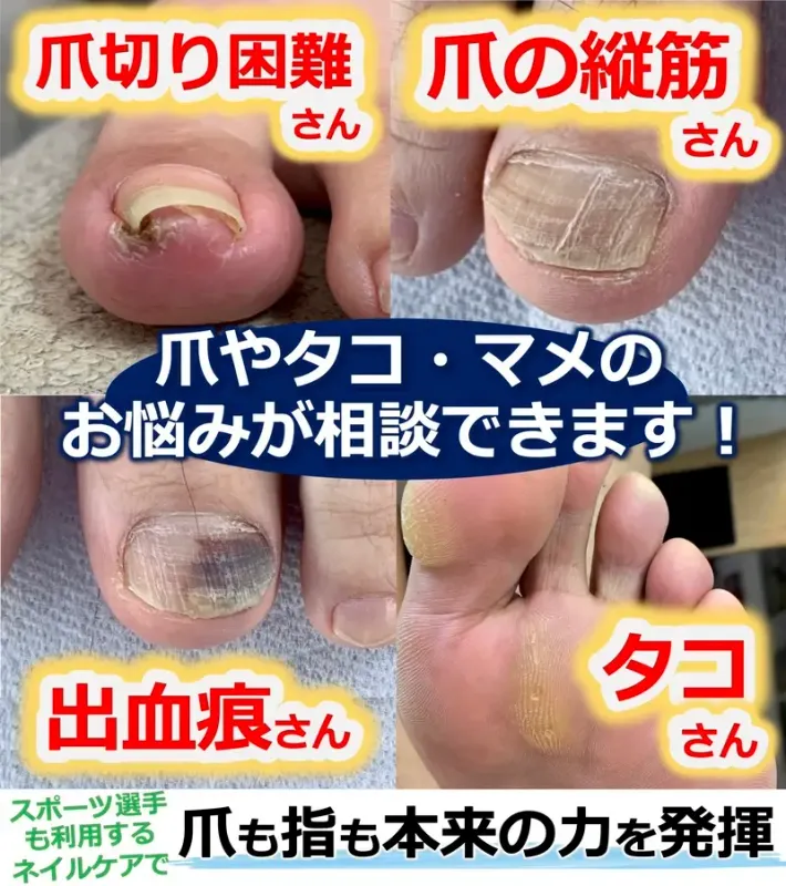 足元から快適な歩行を見直しませんか?